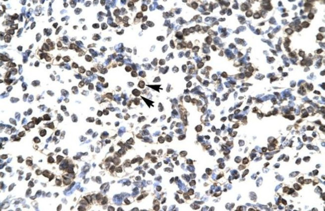 ZNF385A Polyclonal Antibody (PA5-40558)