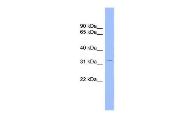 CNOT7 Antibody in Western Blot (WB)