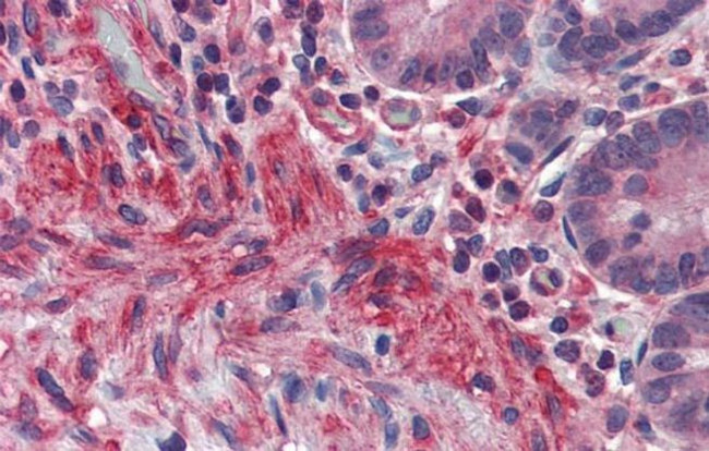 PRDM5 Antibody in Immunohistochemistry (IHC)