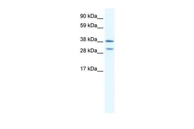 Nkx2.3 Antibody in Western Blot (WB)
