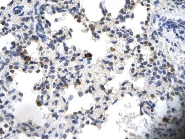 PCYOX1 Antibody in Immunohistochemistry (Paraffin) (IHC (P))