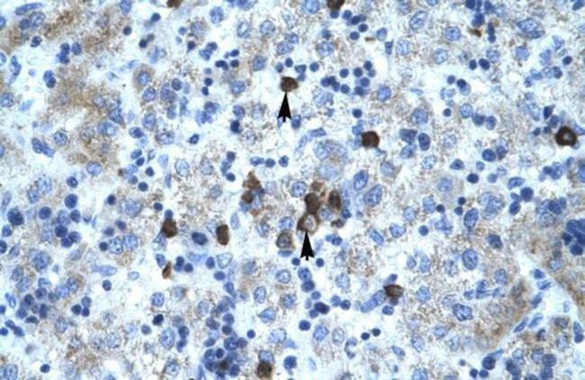 PCYOX1 Antibody in Immunohistochemistry (Paraffin) (IHC (P))