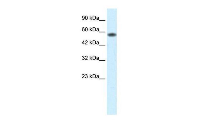 PCYOX1 Antibody in Western Blot (WB)