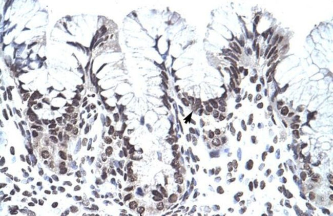 PHF1 Antibody in Immunohistochemistry (IHC)