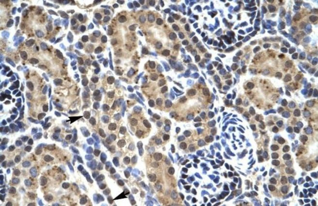 PHKG2 Antibody in Immunohistochemistry (IHC)