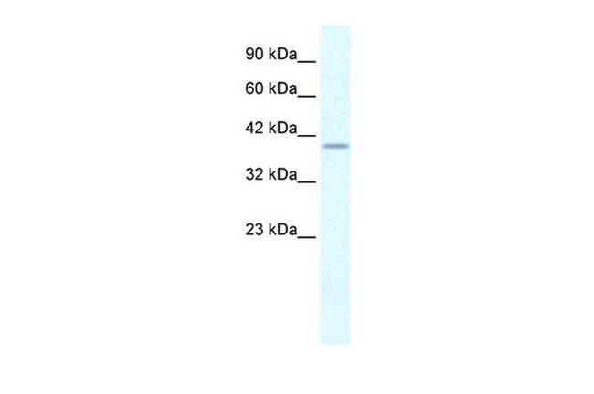 PHKG2 Antibody in Western Blot (WB)