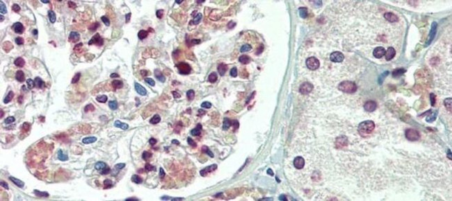 TBX20 Antibody in Immunohistochemistry (IHC)