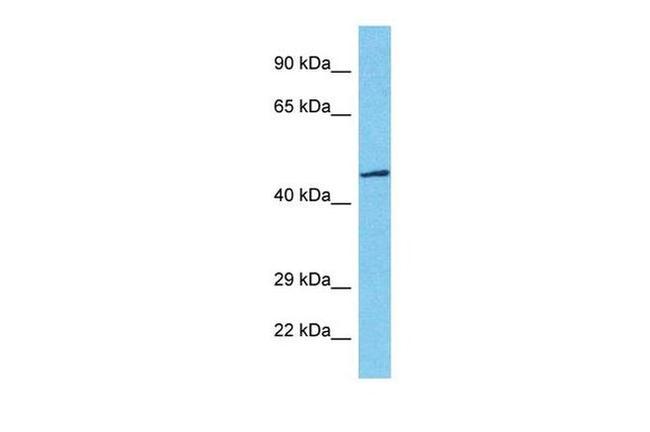 TBX20 Antibody in Western Blot (WB)