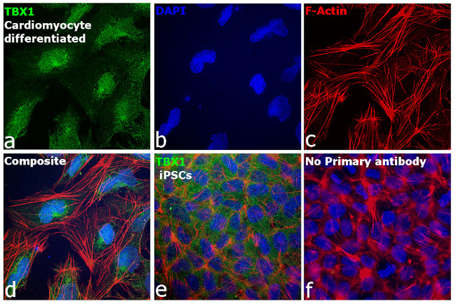 TBX1 Antibody in Immunocytochemistry (ICC/IF)