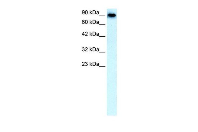 SLC4A1 Antibody in Western Blot (WB)