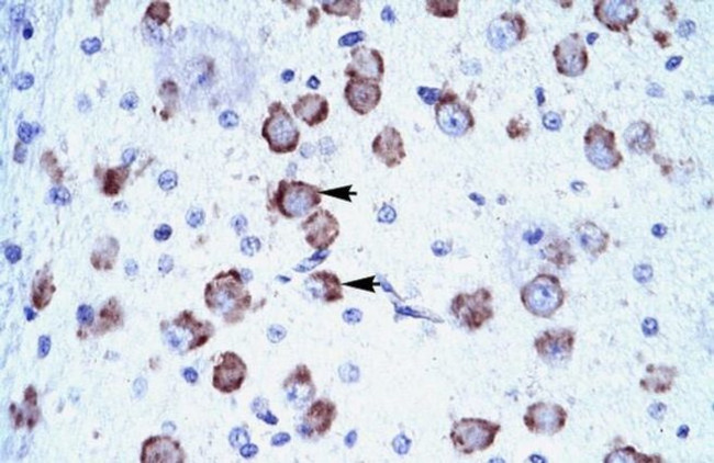 MED17 Antibody in Immunohistochemistry (Paraffin) (IHC (P))