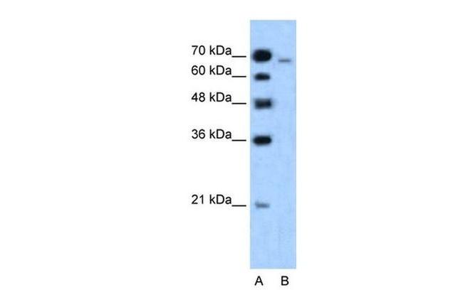 Afadin Antibody in Western Blot (WB)