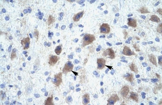 PAX9 Antibody in Immunohistochemistry (Paraffin) (IHC (P))