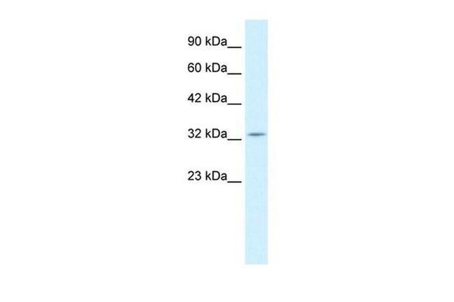 PAX9 Antibody in Western Blot (WB)