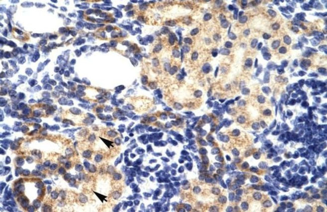 RNF2 Antibody in Immunohistochemistry (IHC)