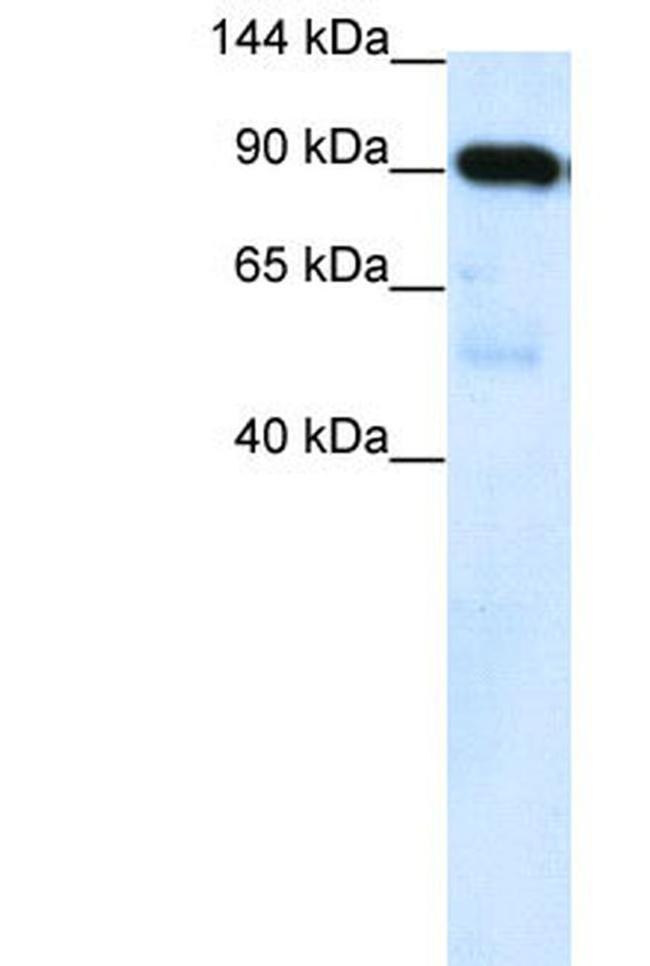 SUV420H1 Antibody in Western Blot (WB)