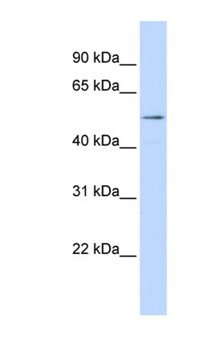 SUV420H1 Antibody in Western Blot (WB)