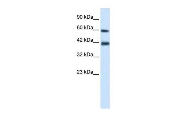 TRIM31 Antibody in Western Blot (WB)