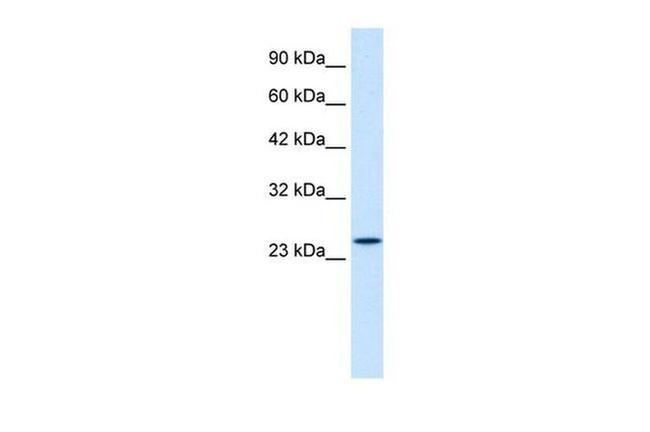 ZNF22 Antibody in Western Blot (WB)