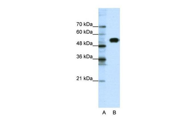 CLCNKB Antibody in Western Blot (WB)