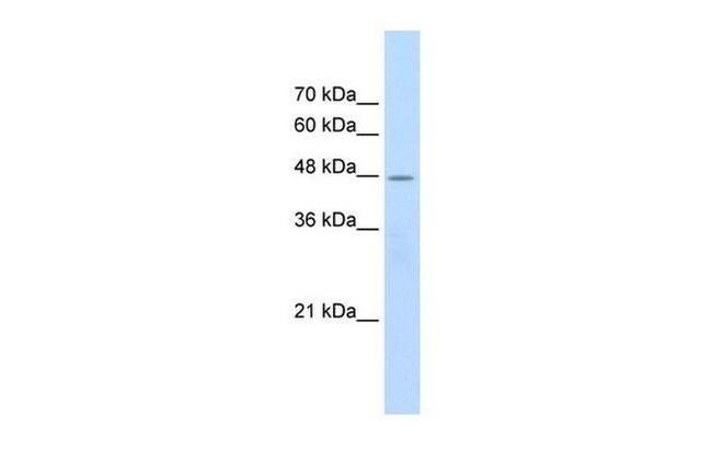 CHRNB2 Antibody in Western Blot (WB)