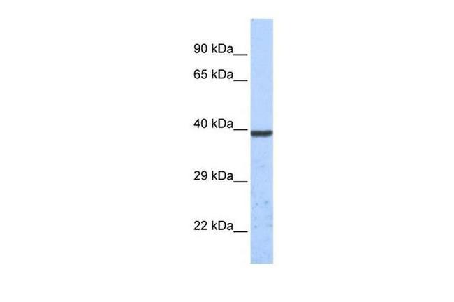 KCNK1 Antibody in Western Blot (WB)