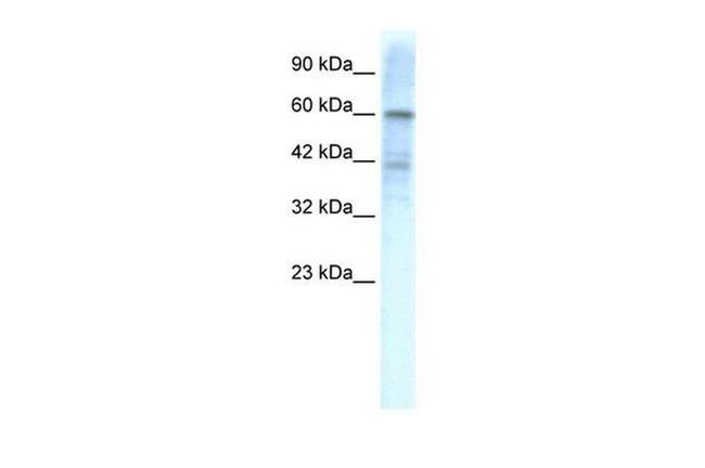 KV4.3 (KCND3) Antibody in Western Blot (WB)