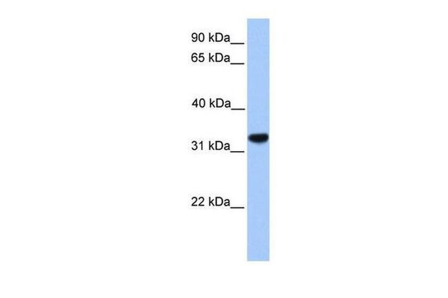 CACNG4 Antibody in Western Blot (WB)