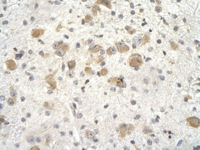 KCTD3 Antibody in Immunohistochemistry (Paraffin) (IHC (P))