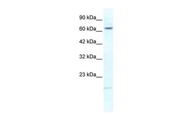 KCNH6 Antibody in Western Blot (WB)