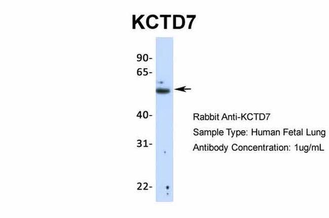 KCTD7 Antibody in Western Blot (WB)