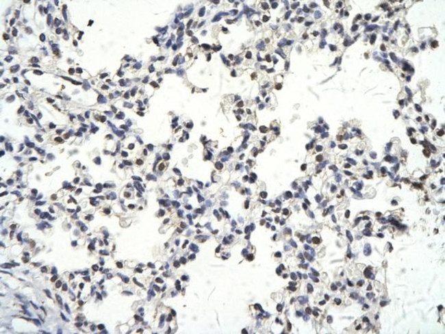 BAF60C Antibody in Immunohistochemistry (Paraffin) (IHC (P))