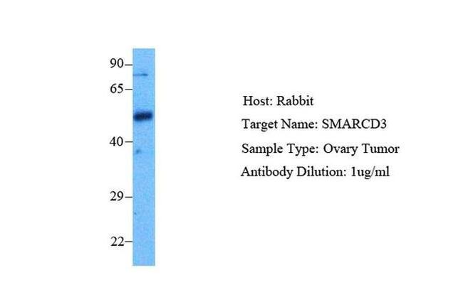 BAF60C Antibody in Western Blot (WB)