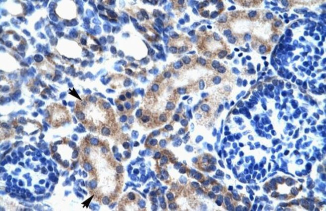 ONECUT2 Antibody in Immunohistochemistry (IHC)