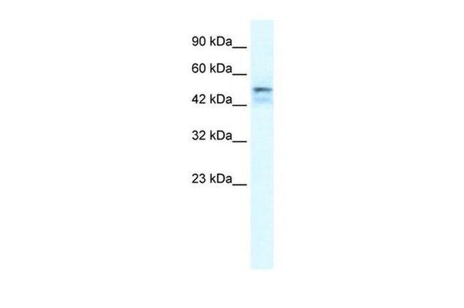 ONECUT2 Antibody in Western Blot (WB)