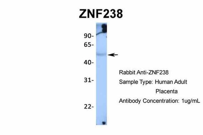 ZNF238 Antibody in Western Blot (WB)