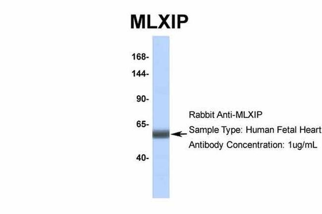 MLXIP Antibody in Western Blot (WB)