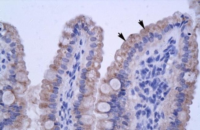 ZNF358 Antibody in Immunohistochemistry (IHC)