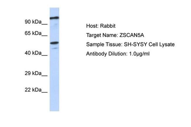 ZSCAN5 Antibody in Western Blot (WB)