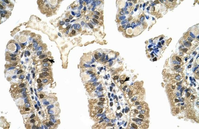 MCM8 Antibody in Immunohistochemistry (IHC)