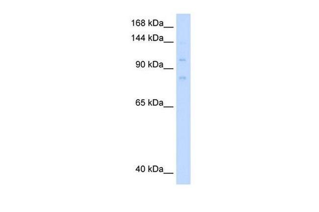 MCM8 Antibody in Western Blot (WB)