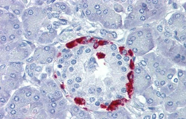 TEAD4 Antibody in Immunohistochemistry (IHC)