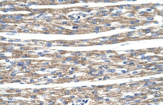 DLX5 Antibody in Immunohistochemistry (IHC)