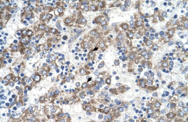 DLX5 Antibody in Immunohistochemistry (IHC)