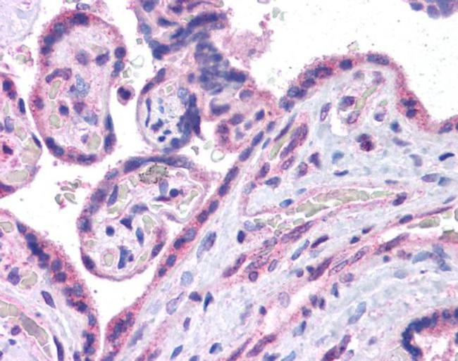 c-MAF Antibody in Immunohistochemistry (IHC)