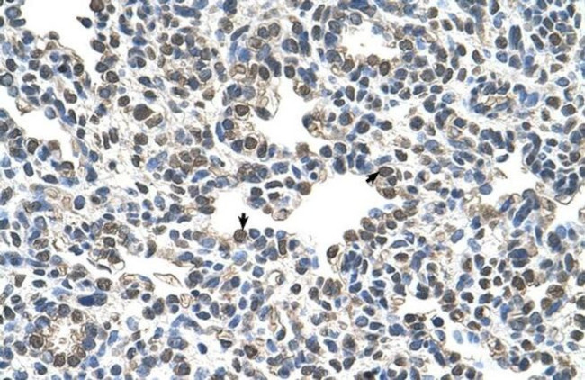 CIZ1 Antibody in Immunohistochemistry (IHC)