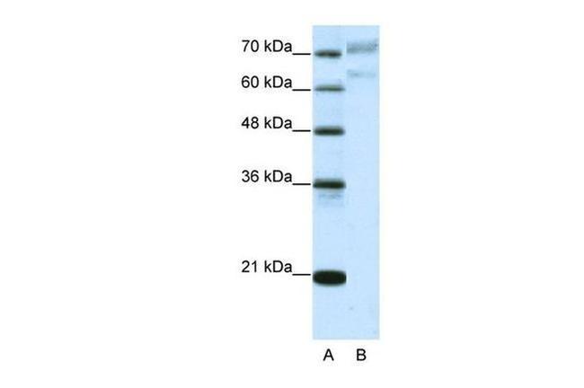 AATF Antibody in Western Blot (WB)