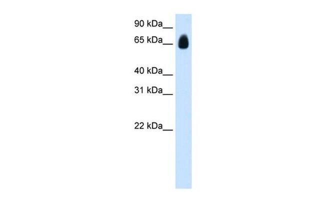 TRIM32 Antibody in Western Blot (WB)