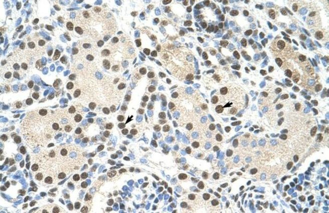 AKAP8L Antibody in Immunohistochemistry (IHC)