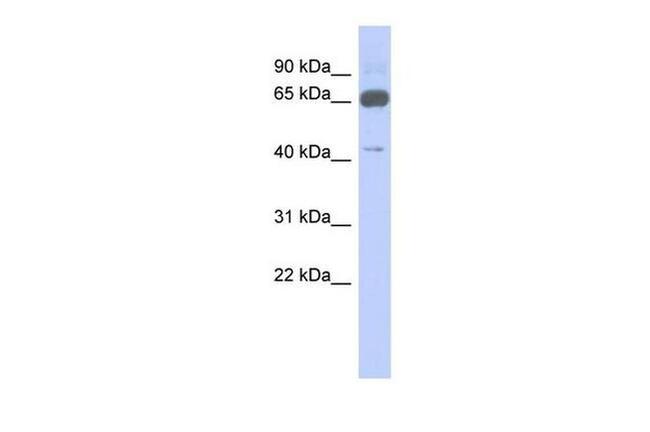 ZNF446 Antibody in Western Blot (WB)